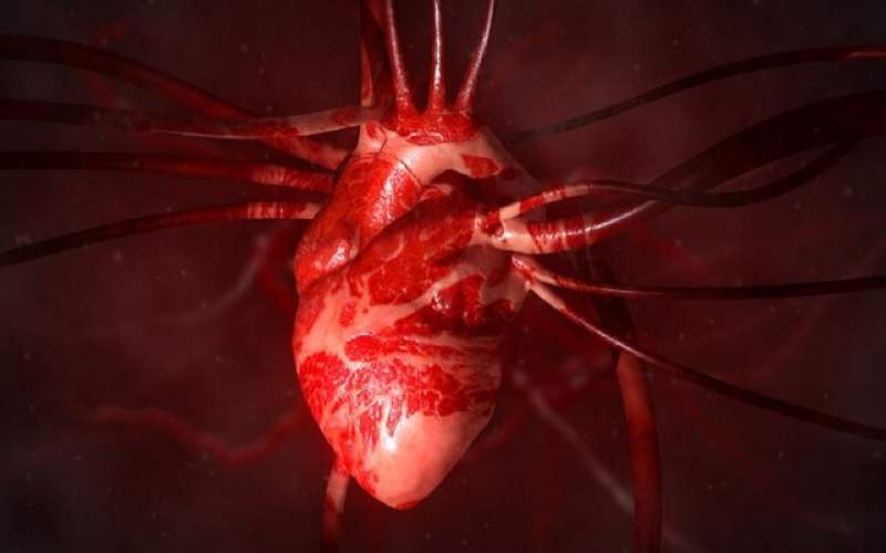 تشخیص سکته قلبی با نانو سنسور