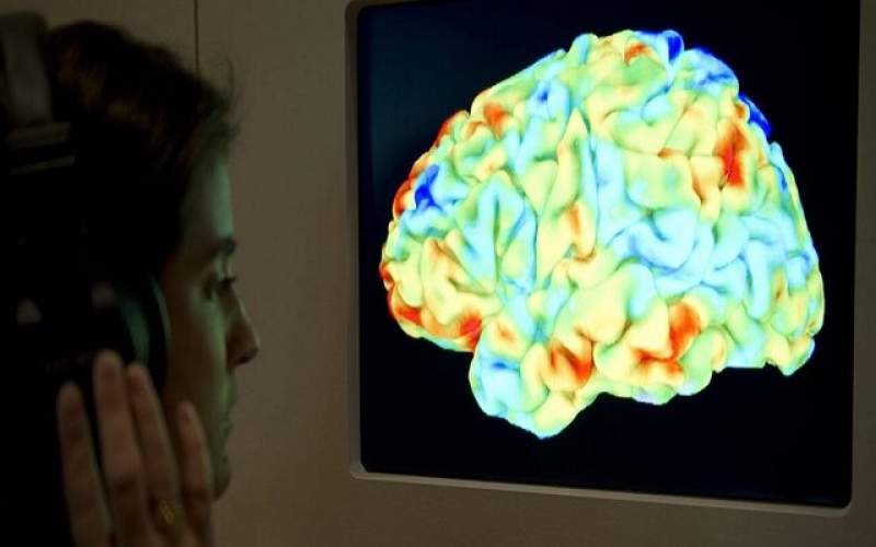 محققان نقش جدید ماده سفید مغز را شناسایی کردند
