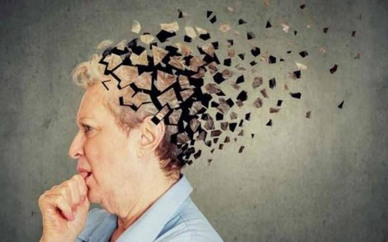 چرا زنان بیش از مردان آلزایمر می‌گیرند؟