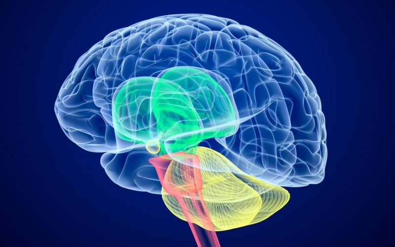 فلج مغزی چیست و چه نشانه‌هایی دارد؟