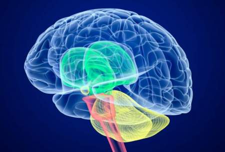 فلج مغزی چیست و چه نشانه‌هایی دارد؟