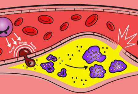 کشف پروتئینی که منجر به بیماری قلبی می‌شود