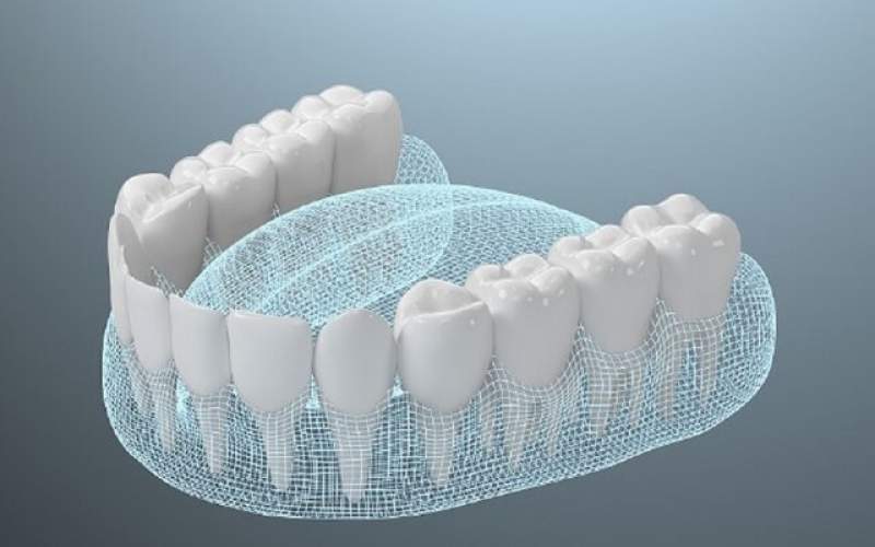 ابداع یک ماده ابریشمی برای پرکردن دندان