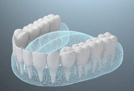 ابداع یک ماده ابریشمی برای پرکردن دندان