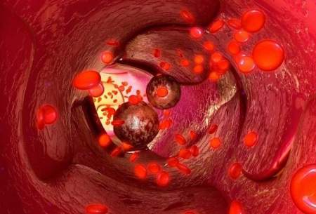 شناسایی عوامل تومورزایی سرطان پانکراس