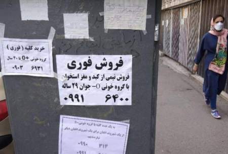 قیمت کلیه در ایران ؛ از ۱۰۰ تا ۳۵۰ میلیون تومان