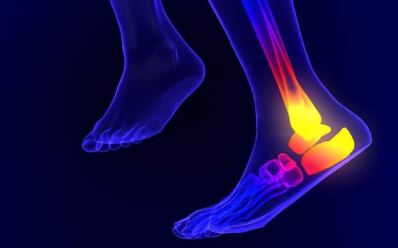 علت گرفتگی عضلات پا در شب چیست؟