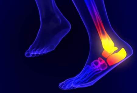 علت گرفتگی عضلات پا در شب چیست؟