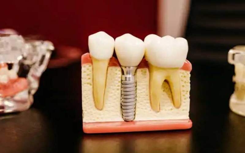 چند نکته مهم درمورد دندان درد باید بدانید