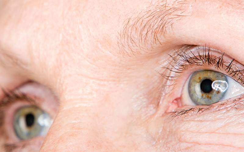 آیا بیماری آب سیاه  چشم قابل درمان است؟