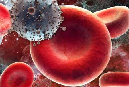 درمان  بیمار مبتلا به ایدز با پیوند سلول بنیادی
