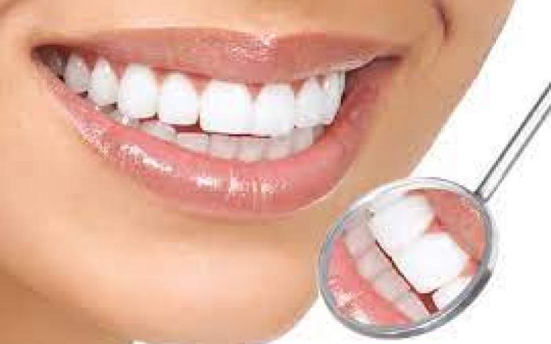 چرا برخی دندان ها استحکام کمتری دارند؟