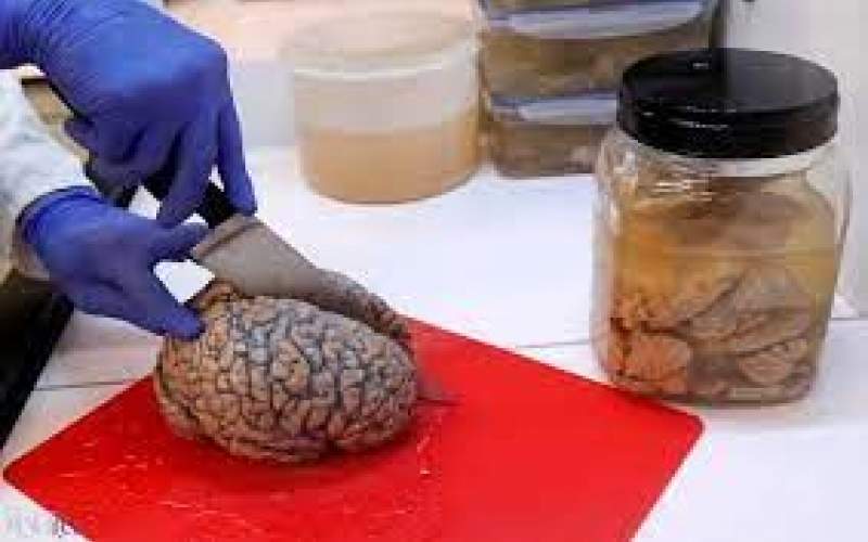 اینجا ۱۰هزار مغز انسان نگهداری می‌شود!