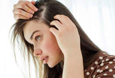 بیماری‌هایی که نشانه آن ریزش مو در زنان است