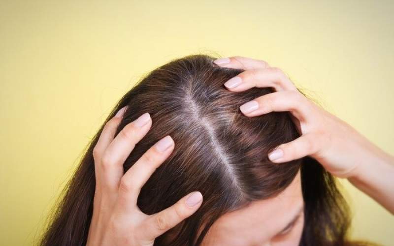 فاکتورهای مؤثر بر سفیدی مو را بشناسید