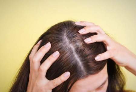 فاکتورهای مؤثر بر سفیدی مو را بشناسید