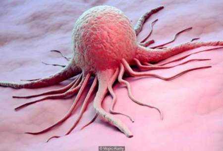 جنگ‌با سلول‌های‌سرطانی‌مغز با رژیم غذایی خاص
