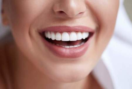 آیا جرم‌گیری برای دندان مضر است؟