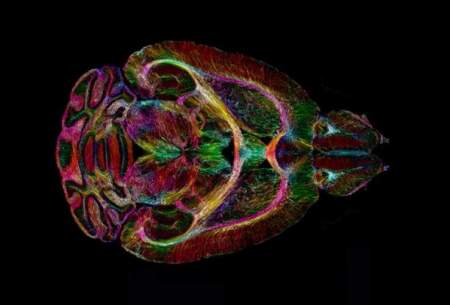 تصویربرداری از مغز ۶۴ میلیون برابر واضح‌تر از قبل