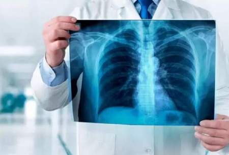 چه میزان از اشعه ایکس خطرناک است ؟