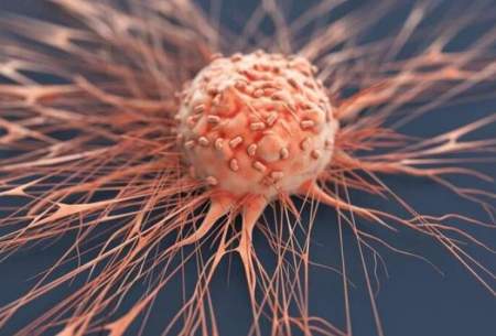 علائم زودهنگام دومین سرطان مرگبار جهان