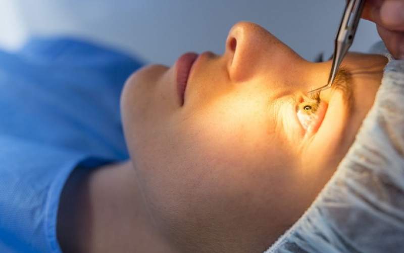 انواع عمل تخلیه چشم و پرسش و پاسخ درباره جراحی