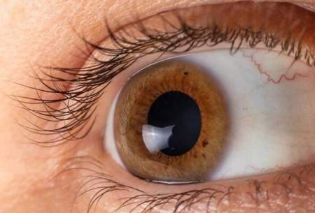 ۶ بیماری که چشم‌ها درمورد آنها هشدار می‌دهند