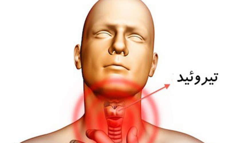 تیروئید چیست و چگونه درمان می‌شود؟