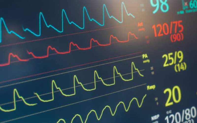 نظارت بر علائم حیاتی بیمار از راه دور