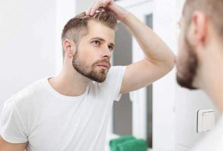 علت‌های مختلف ریزش مو در مردان