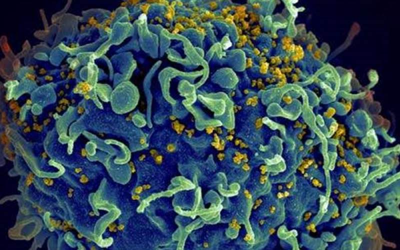 کشف راهکار امیدوار کننده برای درمان ایدز