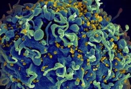 کشف راهکار امیدوار کننده برای درمان ایدز