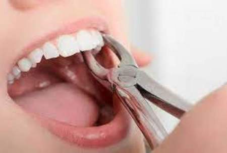 مراقبت‌‌‌های لازم پس از کشیدن دندان عقل