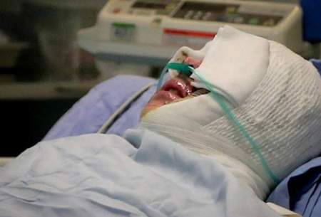 اسیدپاشی به پسر ۲۱ ساله در مشهد