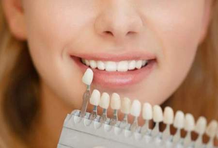 راهکارهای جالب برای تقویت مینای دندان