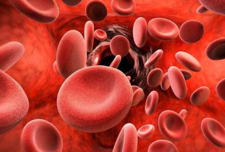 ۱۳ راه درمان طبیعی برای درمان عفونت خونی