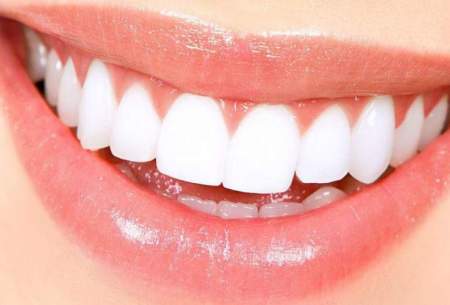 ۱۰ روش برای سفید کردن طبیعی دندان‌ها
