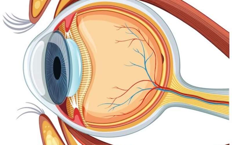 بیماری AMD ؛ مهم‌ترین علل کم بینایی