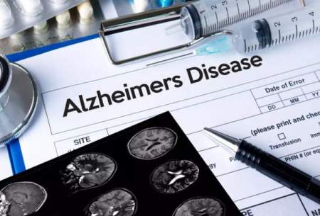 شناسایی داروی جدید برای آلزایمر