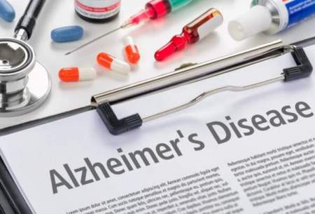 پیشگیری از بیماری آلزایمر با روش جدید