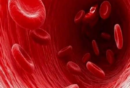 علائم لخته شدن خون را بشناسید