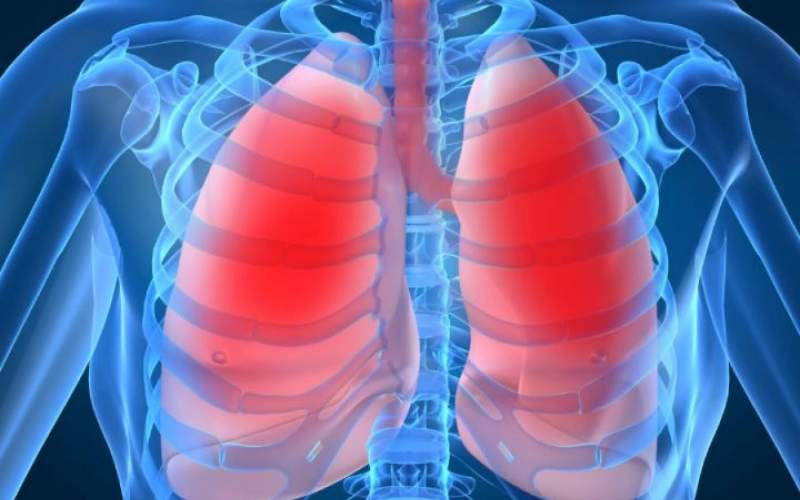6 عامل اصلی که باعث آسم می‌شود