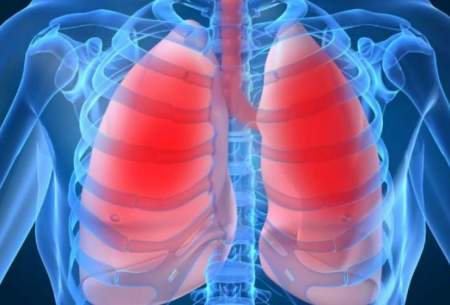 6 عامل اصلی که باعث آسم می‌شود