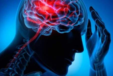 علایم و نشانه‌های سکته مغزی را بشناسید