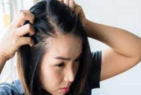 جلوگیری از ریزش مو در زنان با انجام این سه کار