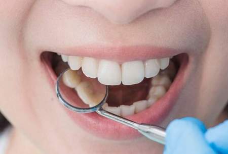 بیماری‌هایی که با معاینه دندان فاش می‌شود