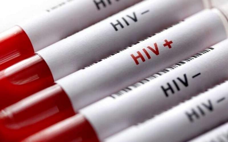 آخرین وضعیت HIV در کشور