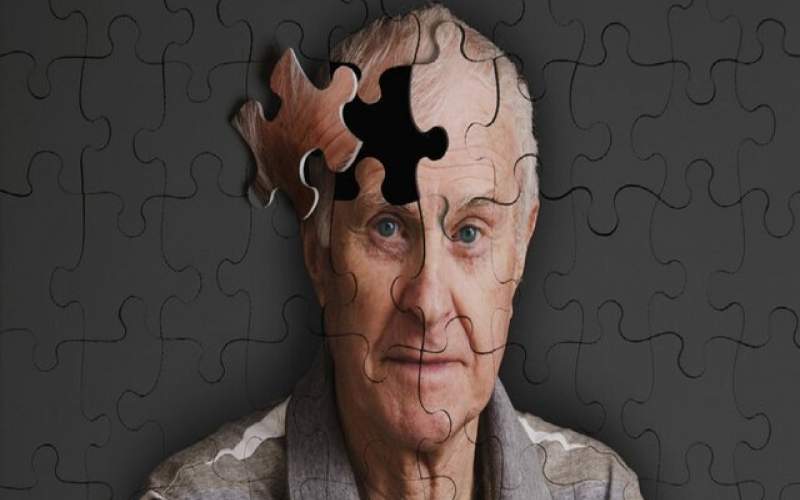ردپای کم تحرکی در بروز آلزایمر و  افسردگی
