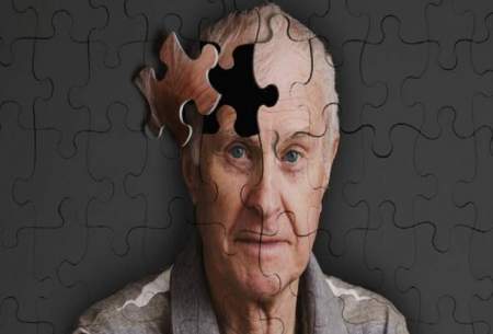 ردپای کم تحرکی در بروز آلزایمر و  افسردگی