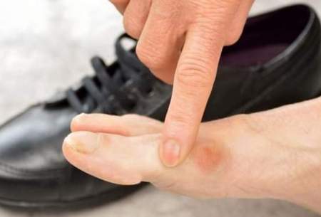 کفش نامناسب عامل چه بیماری‌هایی است؟